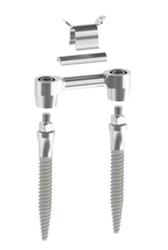 Cortex Dynamix Internal Hex Dental Implant Spotimplant