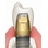 BioHorizons Tapered Internal image 66