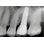 Almitech Implant System Almitech image 5