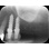 Trinon Titanium Q image 1
