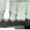 Dentsply Sirona XiVE S (Friadent) image 2