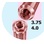 Conexão Master Screw/Porous image 9