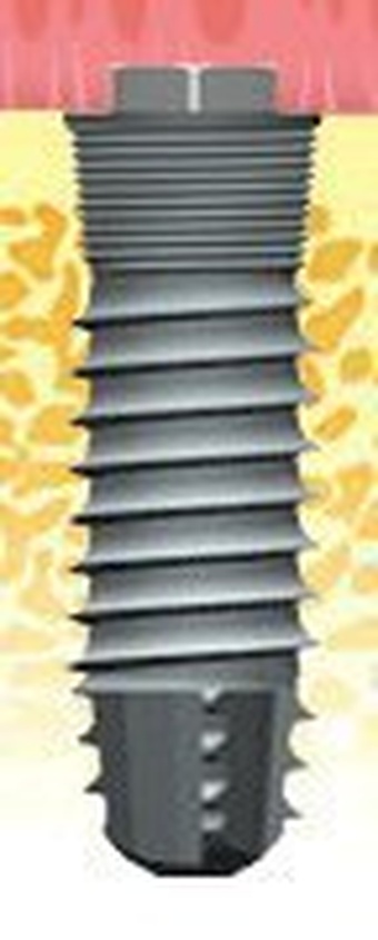 Atlas External main image