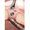 Intra-Lock System International External Hex image 1
