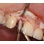 Intra-Lock System International External Hex image 2