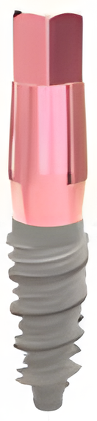 Dental Implants With V-Shaped Threads | SpotImplant