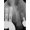 Sargon Dental Implants Sargon Standard image 2
