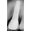 Almitech Implant System Almitech image 3