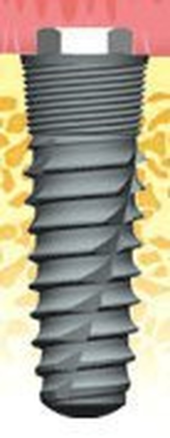 Atlas External Tapered main image