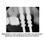 Biodenta Bone Level-BL image 2