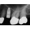 Nobel Biocare NobelReplace Tapered image 4
