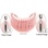 IMTEC Sendax MDI Collared (O-Ball Head) image 4