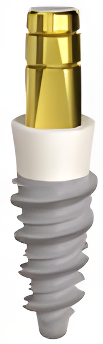 Dental Implants With V-Shaped Threads | SpotImplant