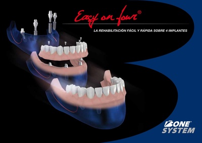 BoneSys-easyonfour-15-ES.pdf