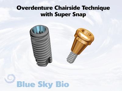 Conus201220Overdenture20Super20Snap20Chairside20Technique.pdf