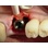 Sargon Dental Implants Internal Connection-Wide image 5