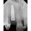 BioHorizons Tapered Internal image 1