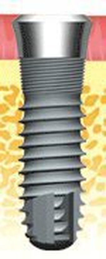 Atlas Internal Straight main image