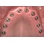 Nobel Biocare Branemark System MK IV image 1