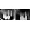 Nobel Biocare NobelActive image 32