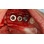 Southern Implants Tri-Nex Tapered image 2