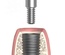 Implantat-Verschlussschraube
