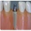 Hi-Tec Implants TRX-OP image 5