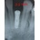 IMTEC Endure CL image 3