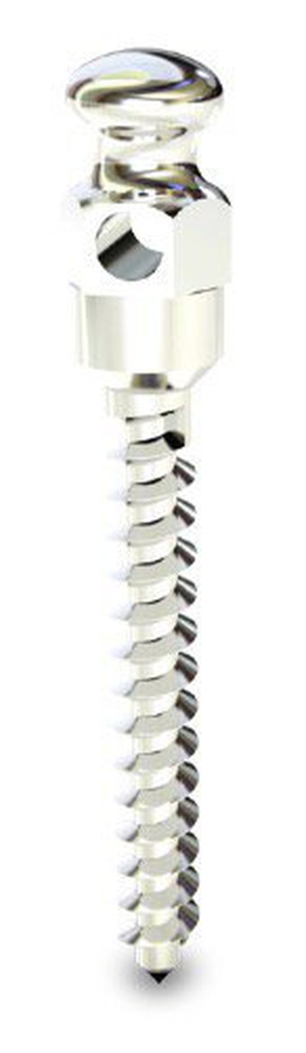 Titanium Fix B-fix Black-Fix Dental Implant | SpotImplant