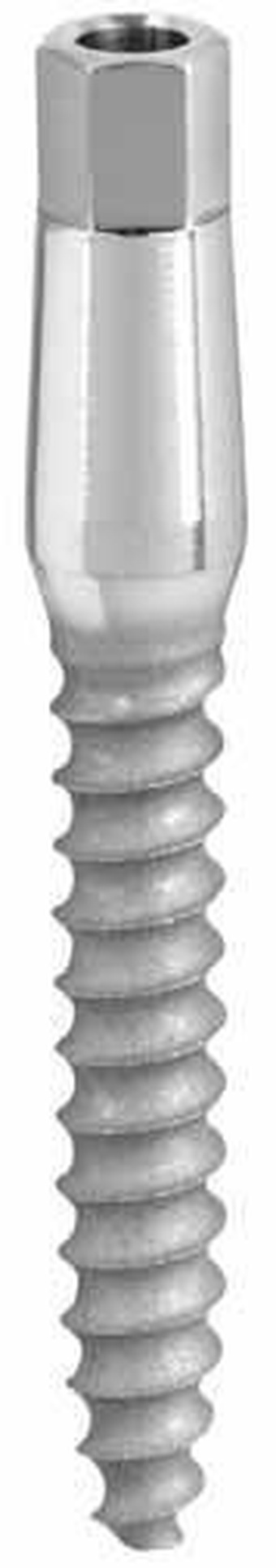 Dental Implants With V-Shaped Threads | SpotImplant