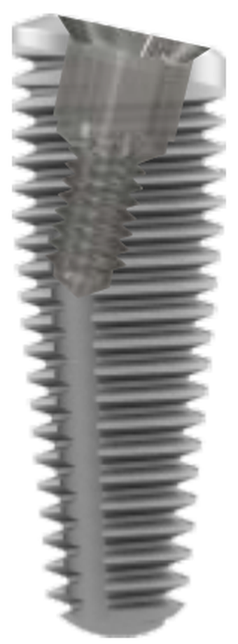 Southern Implants Promax Dental Implant Spotimplant