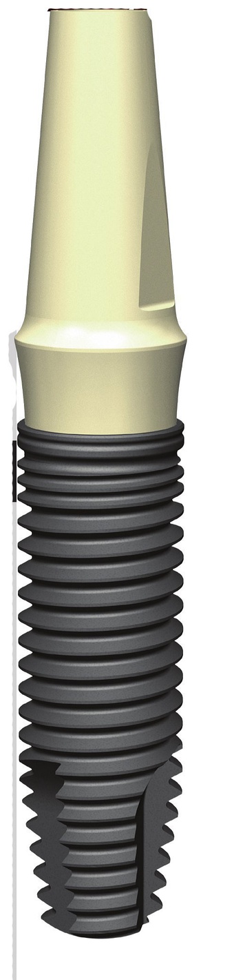 Periotype (Clinical House) PerioType X-Class Dental Implant | SpotImplant