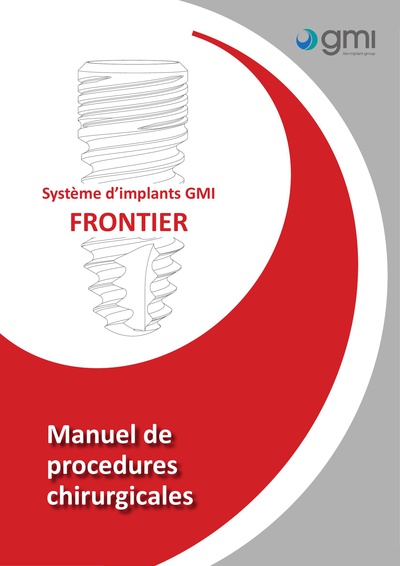 Gmi Global Medical Implants Frontier Dental Implant Spotimplant