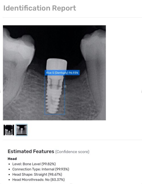 How to Identify a Dental Implant