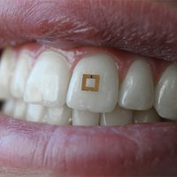 L'IOT Diet Wearable2.jpg