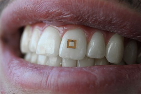 Overview of AI applications in dentistry