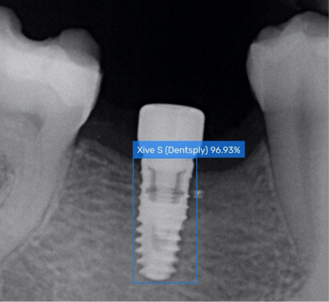 Dental Implant Identification Service AIbased Spotimplant