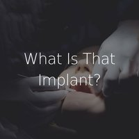 What Is That Implant_.jpg