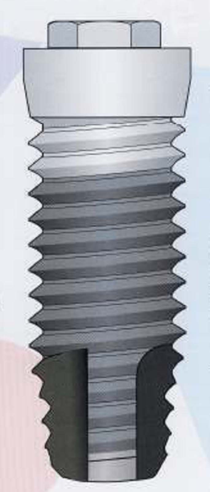 ACE Surgical Supply Standard RBM Implant dentaire SpotImplant