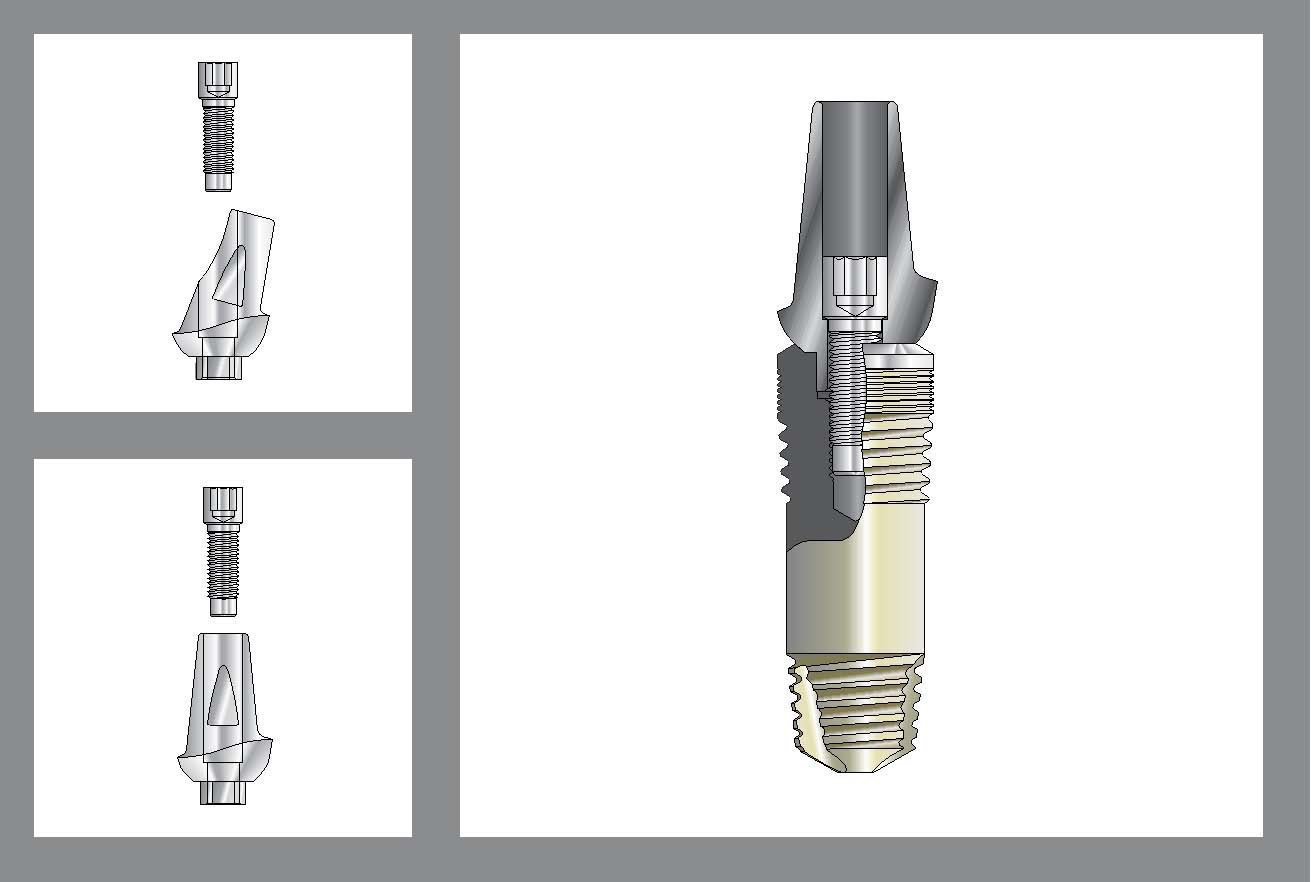 TwoStage Implante dental SpotImplant