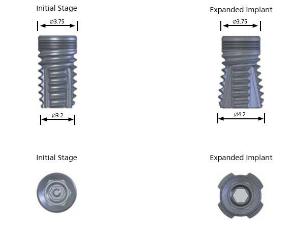 Quad Internal Hex main image
