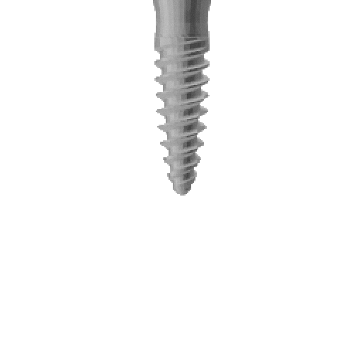 Dentium SlimLine Dental Implant | SpotImplant