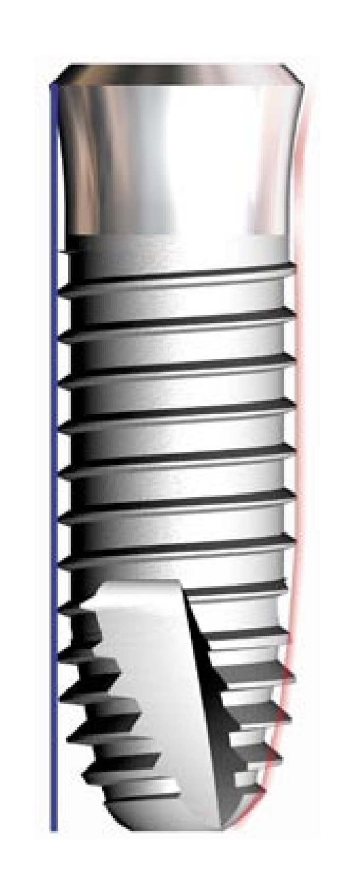 Dyna Dental Helix TM Dental Implant SpotImplant