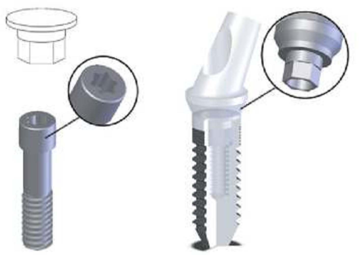 IDI Evolution Stone Dental Implant SpotImplant