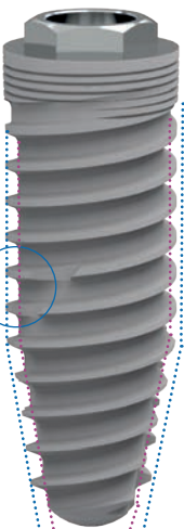 ZM1 main image