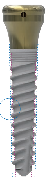 ZMK main image