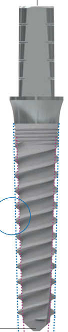 ZMR main image
