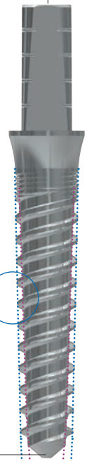 ZMR S main image