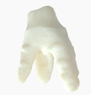 Anatomic Ceramic Molar main image