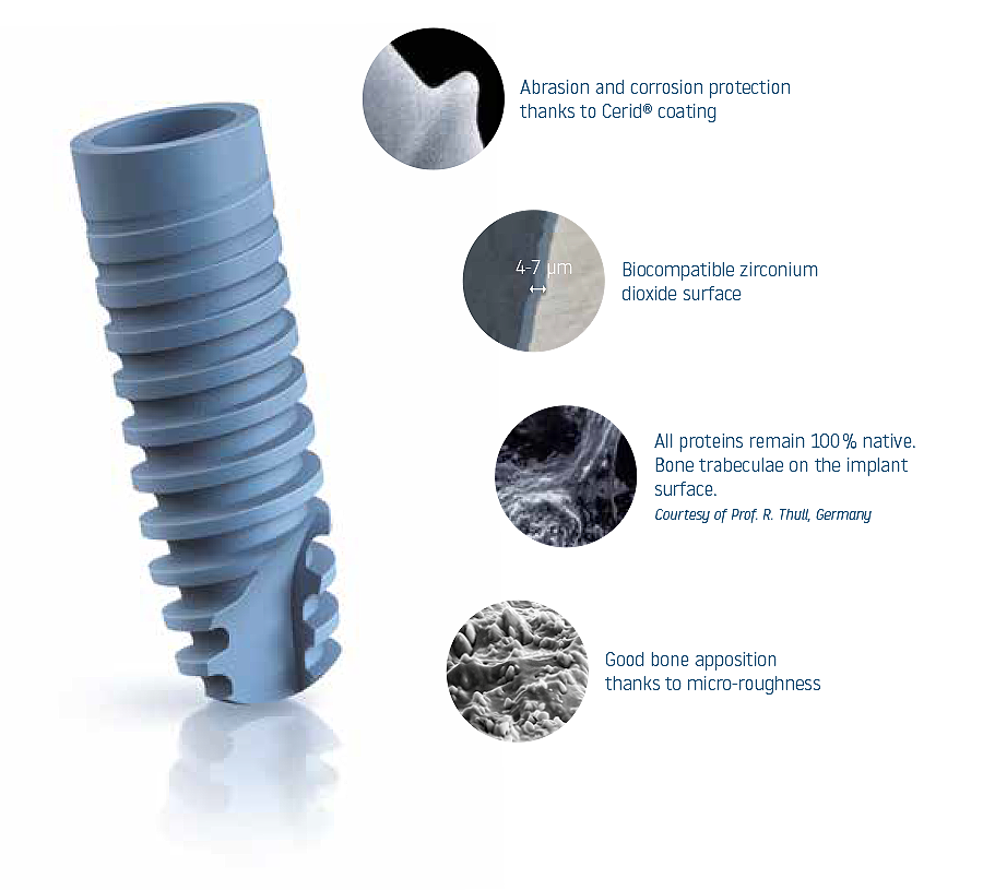 Hager & Meisinger myplant bio Implante dental SpotImplant